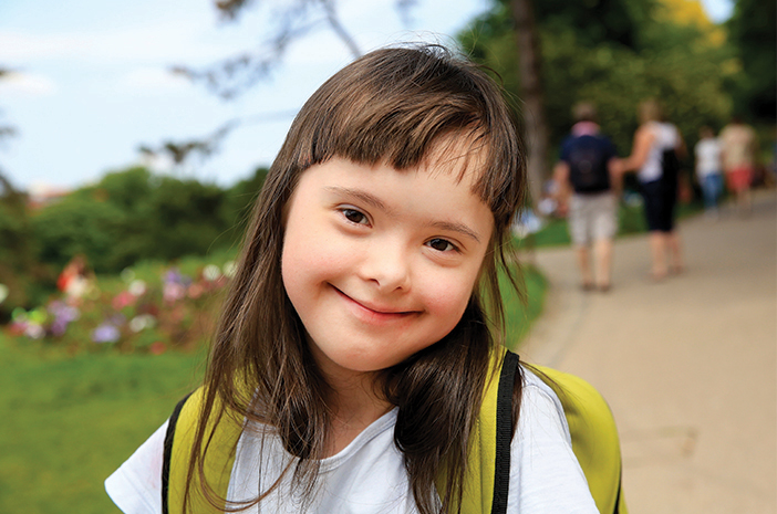 Kondisi Genetik Seseorang Pada Down Syndrome