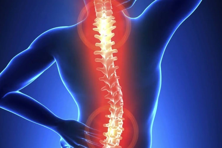 Kondisi Medis Pada Seseorang Saraf Kejepit