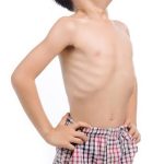 4 Cara Ampuh Cegah Cacingan Pada Anak Dan Dewasa
