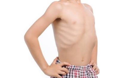 4 Cara Ampuh Cegah Cacingan Pada Anak Dan Dewasa