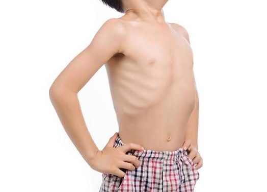 4 Cara Ampuh Cegah Cacingan Pada Anak Dan Dewasa